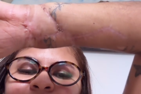 Após fingir estar morta para sobreviver, Ana Clara emociona ao revelar evolução da recuperação