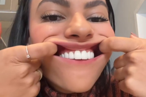 A influenciadora Luiza Liz  chocou os seguidores ao revelar que removeu todos os dentes naturais e atualmente usa dentadura.