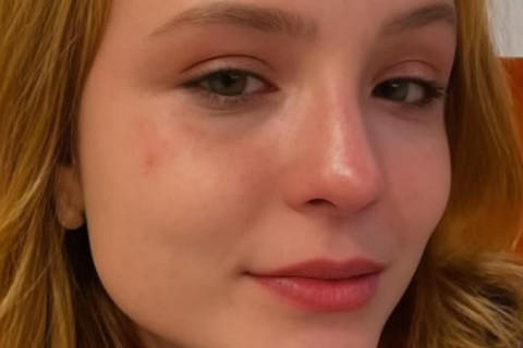 Larissa Manoela revela luta contra endometriose e faz alerta às mulheres