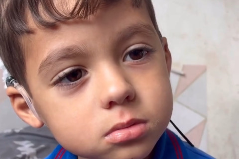 Garotinho com surdez profunda ouve a voz da mãe pela primeira vez e se emociona