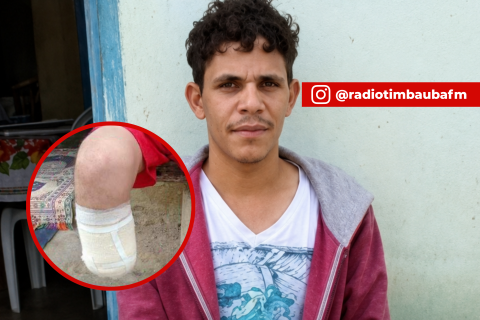 Servidor público é condenado após amputar o próprio pé para tentar receber R$ 1,5 milhão de seguradoras na Bahia