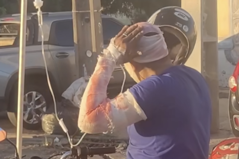 Vídeo mostra homem supostamente ferido e com curativos pilotando uma moto para trabalhar