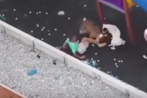 Criança é atacada por pitbull em parque e sofre ferimentos graves
