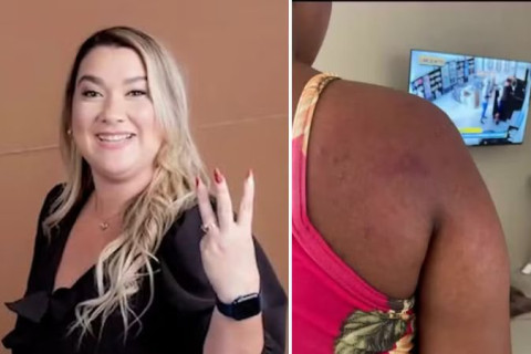 Patroa agride doméstica grávida após sumiço de anel e confessa que “bateu até a mão inchar” e com ajuda de policial