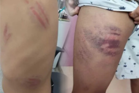 MATO GROSSO DO SUL Menino autista é esp4nc4do em escola por mãe de aluno