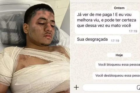 Mulher joga água fervendo no ex para escapar de tentativa de feminicídio