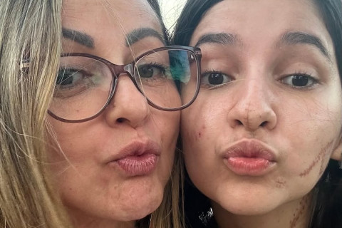 Após dias de dor e luta, Alana volta a sorrir em passeio com a mãe e emociona